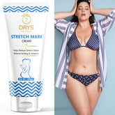 Natural ways to prevent stretch marks during pregnancy cream