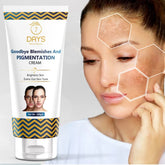 7 Days pigmentation Cream for Acne Scar Removal Pigmentation, Dark Spots & face Glowing (100 g)