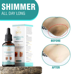 7 Days Whitening Serum For Removing Dark Knuckles Elbow and Knee (30 ml)