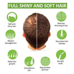 Green Apple Shampoo for Dandruff (100 ml)