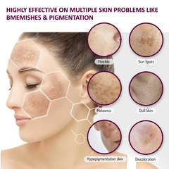 Dark Spot Remover Serum | Dark Spot Brightening Facial Serum | 7Days Organic