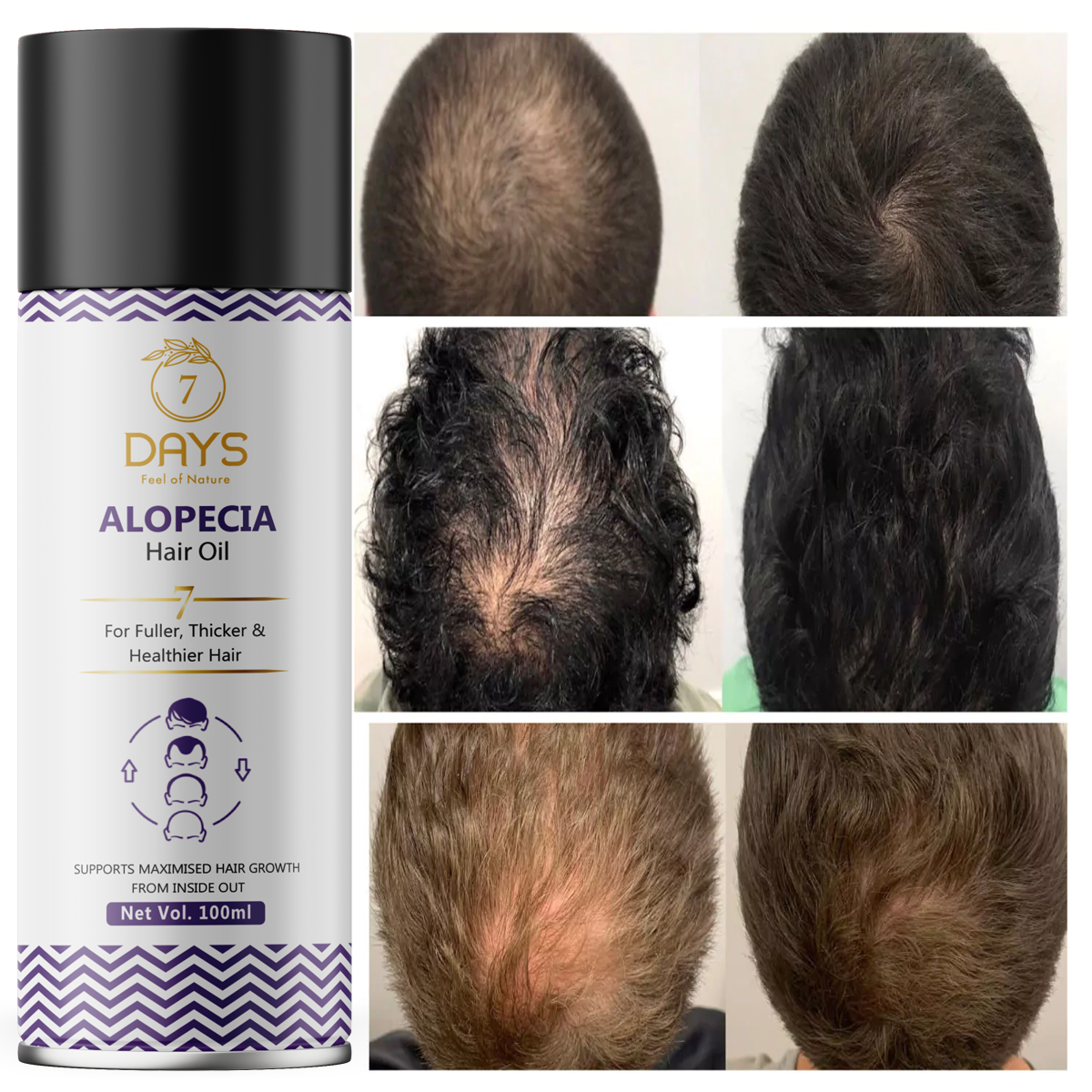 7 Days Alopecia Hair oil with Ginger, Onion, Shikakai for Hair Gowth Stop Hair  Fall Hair Oil (100 ml) – 7 Days Organic